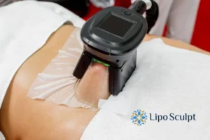 Cryolipolysis Helping You Getting that Perfect Summer Body 3 Cryolipolysis Surrey can give you the best summer body - contact us today!