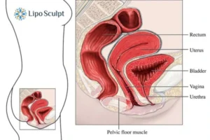 Treatment For A Leaky Bladder 2 How EM Chair treatment Surrey can help Leaky bladder issues. Read more now!